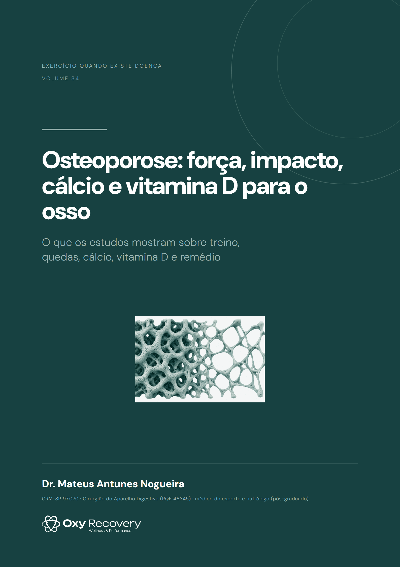 Capa do ebook Osteoporose: força, impacto, cálcio e vitamina D para o osso